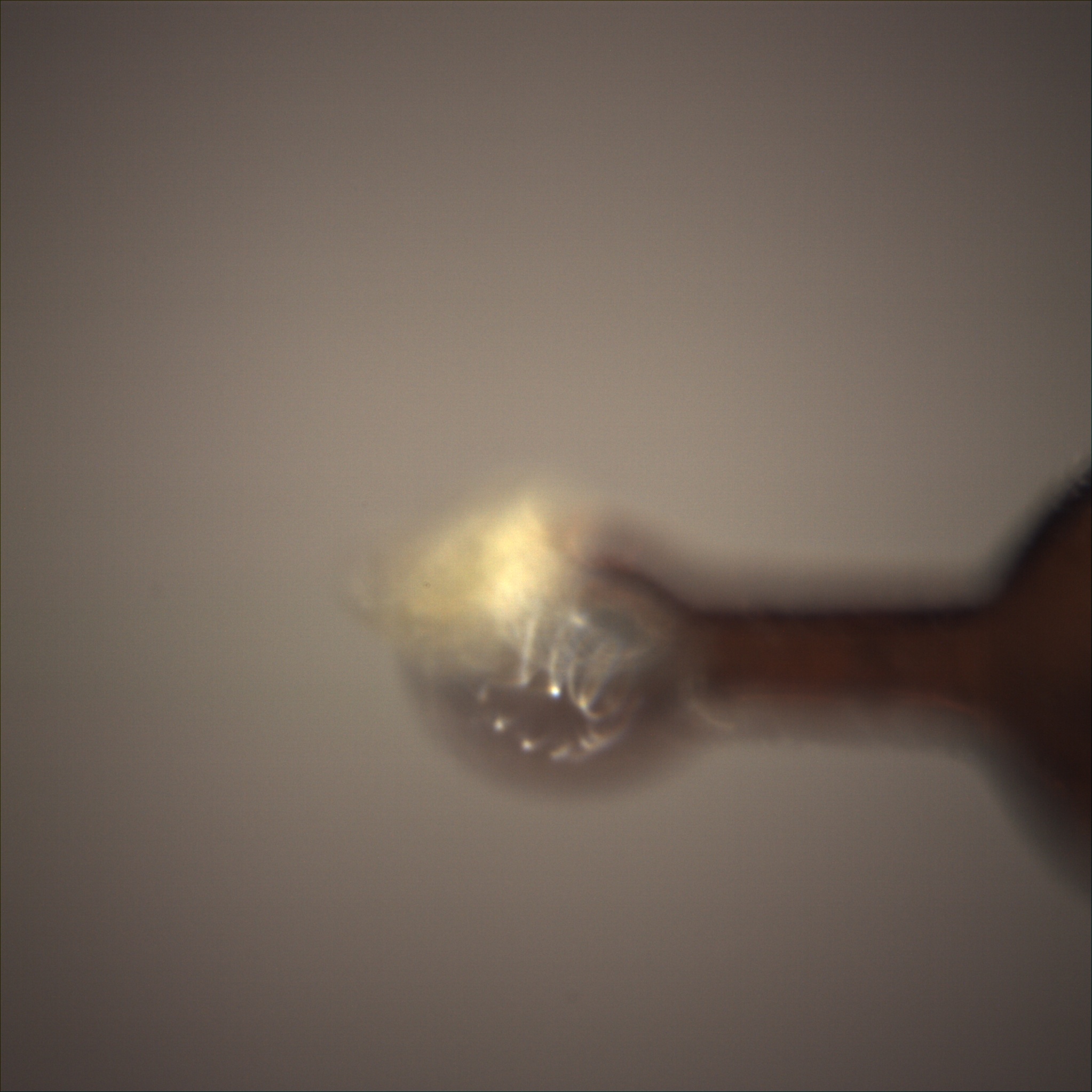 /gotthard_g/aaredb/raw/branch/main/backend/tests/sample_image/after_dc.jpeg.jpg